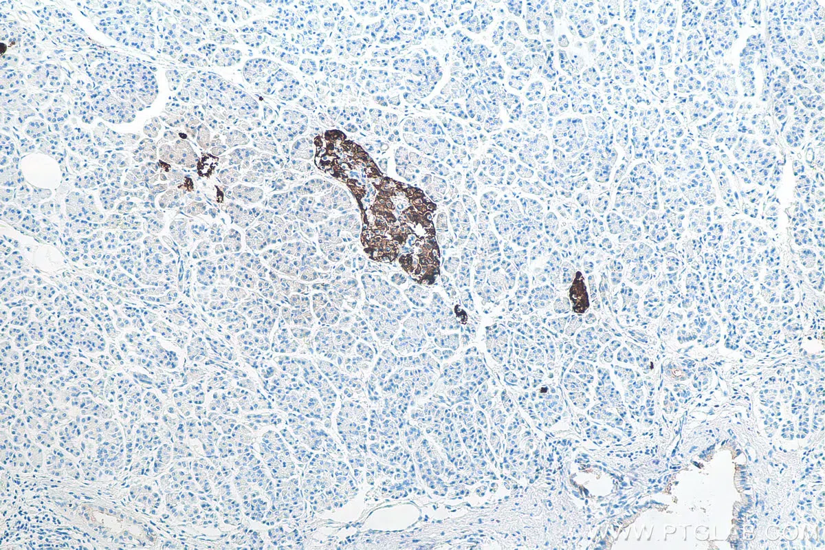 Antivielas